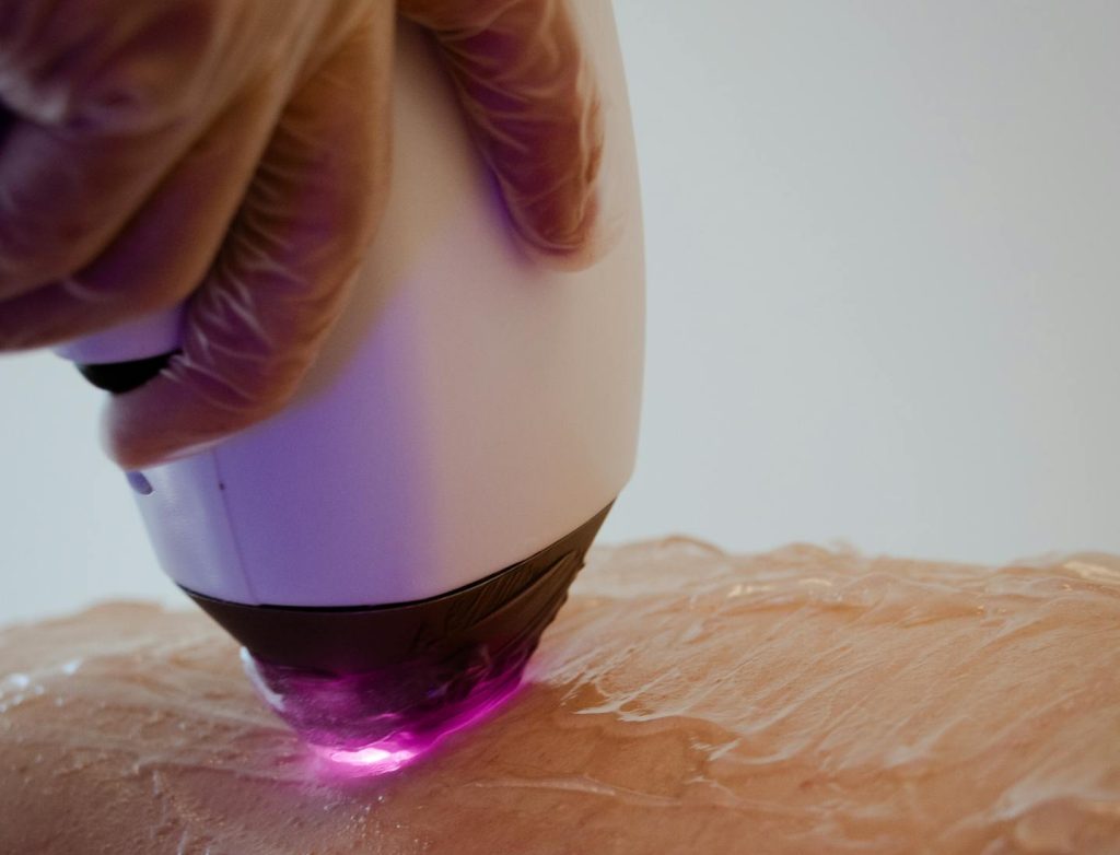 Close-up of laser skincare treatment on skin with visible hand holding device.